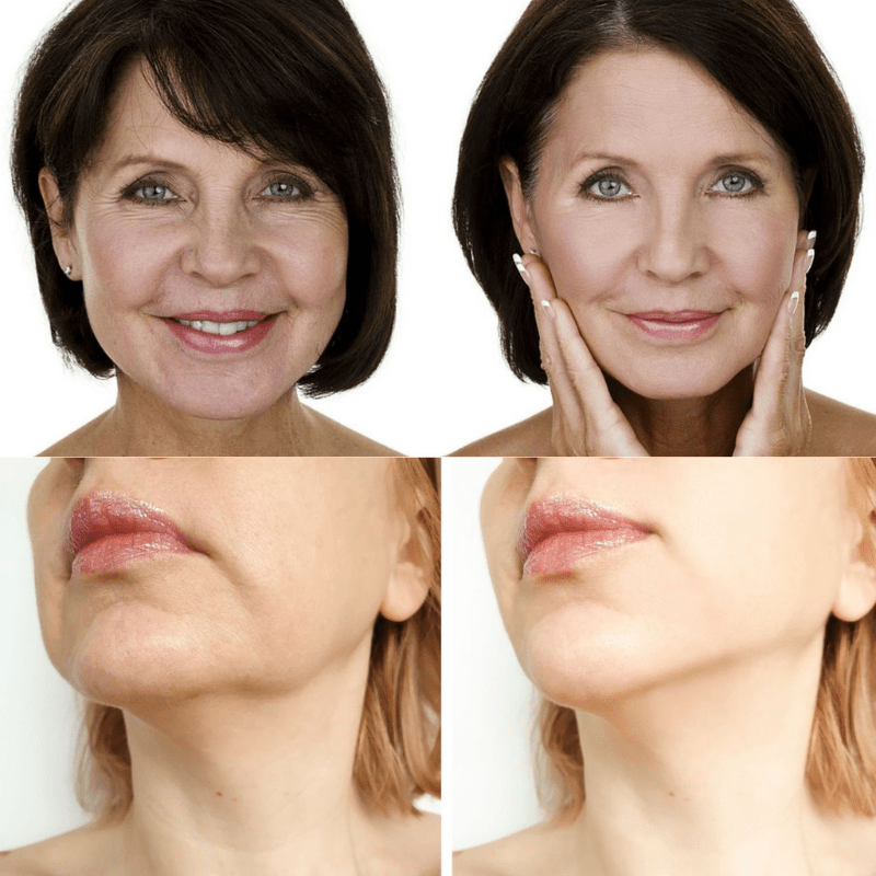 Face Glow 2.0® - Definição e Rejuvenescimento + Brinde - Loja Descontou!